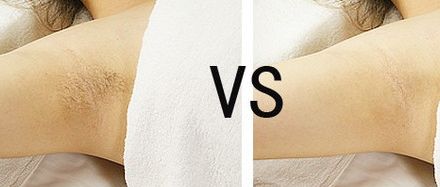 杭州注射豐下巴哪家好？螞蟻醫(yī)生為您推薦最靠譜的美容機構