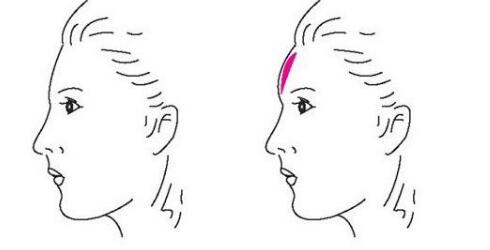 激光美膚祛斑真的能有效去除斑點(diǎn)和粉刺嗎？多少人見(jiàn)到明顯的效果了嗎？