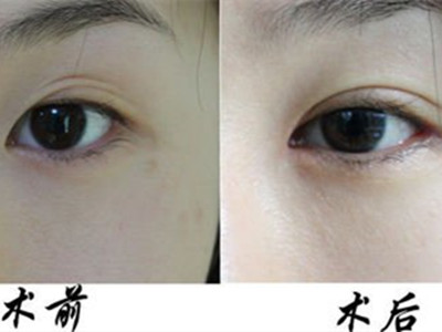 你是否知道2023貴陽(yáng)大型整形醫(yī)院的口碑是如何的？應(yīng)超+美貝爾是否是您不可錯(cuò)過(guò)的選擇？安全是否有保障？