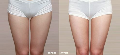 上海最好的削骨手術(shù)醫(yī)院有哪家？