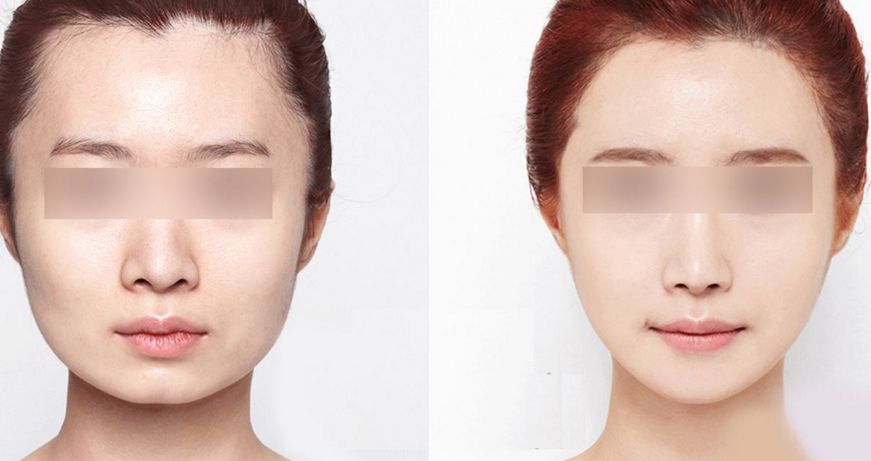 北京眼角提升醫(yī)院排名前十私立醫(yī)療整形機構推薦