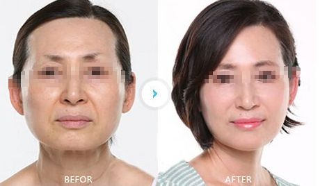 鹽城哪些醫(yī)院可以進(jìn)行面部修復(fù)手術(shù)？曼麗莎醫(yī)院面積達(dá)3000平方米