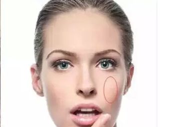 煙臺(tái)眉弓整形醫(yī)院指南：精選前十