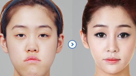 廣州中家醫(yī)黃廣香隆胸術(shù)：價格公開+專家聲譽+技術(shù)口碑詳解