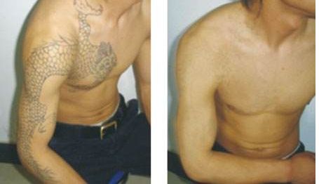 深圳著名吸脂減肥整形美容醫(yī)院排行榜揭秘