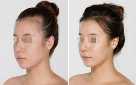 武漢紅血絲治療醫(yī)院排行榜TOP10大揭秘！