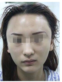 寧波祛斑皇后排名前十大醫(yī)院盤點，一網(wǎng)打盡！