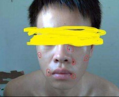 北京額頭提拉術(shù)醫(yī)療整形醫(yī)院排名及口碑TOP10！