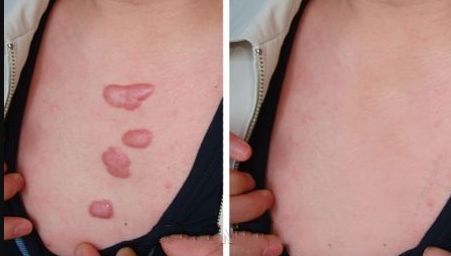 廣州點陣激光祛細紋，哪家醫(yī)院口碑好？排名前十公開啦！