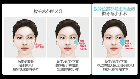 長(zhǎng)沙乳房整形巔峰醫(yī)院排行榜公布！湘雅三院、亞韓、協(xié)雅等，十大對(duì)比曝光！