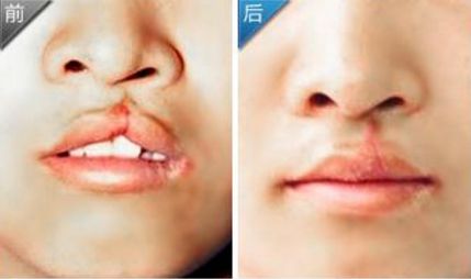 廣西口碑優(yōu)異的10家肩頸護(hù)理醫(yī)院，實(shí)力不容小覷！