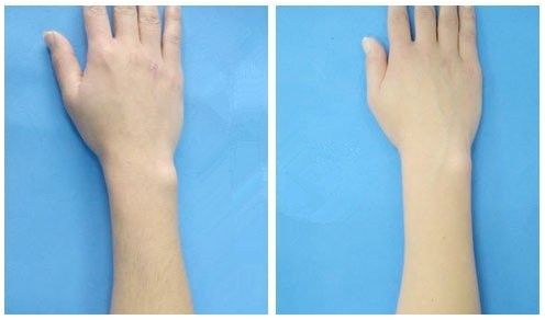 2023天府之國成都隆鼻技術(shù)精湛，實力醫(yī)生名單揭秘！