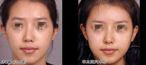 湖南脂肪填充肥胖紋優(yōu)質(zhì)醫(yī)美機(jī)構(gòu)推薦TOP10