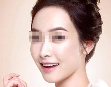 上海美萊隆鼻：專業(yè)技術(shù)，細(xì)致操作，完善服務(wù)！