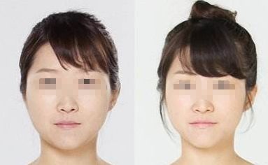 青島十大正規(guī)美容醫(yī)院推薦，維拉塑身早早上新！