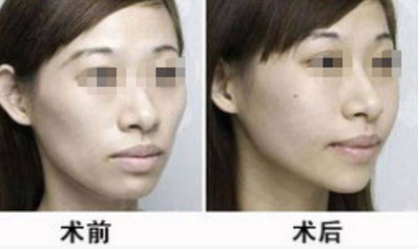 深圳眼袋抽脂手術(shù)醫(yī)院排名TOP10及消費者評價