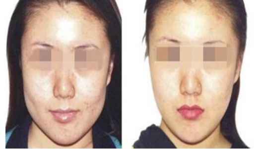 鄭州整形醫(yī)院口碑逐鹿：嘟嘟唇項(xiàng)目十強(qiáng)前哨摸底