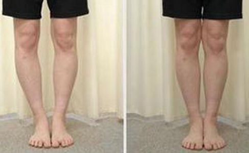 北京奧美定取出哪里首選？京美人氣專家劉成勝同取同做全方位解析