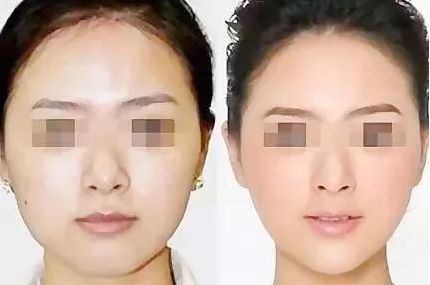 齊齊哈爾副乳切除效果好的醫(yī)院有哪些？盤點(diǎn)口腔醫(yī)院排行榜！