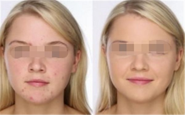 鄭州眼角下垂手術(shù)哪家醫(yī)院做得好？這十大醫(yī)院不容錯(cuò)過！