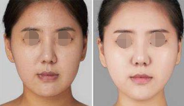 中山像素激光換膚醫(yī)院口碑排行榜：前十強(qiáng)實(shí)力機(jī)構(gòu)點(diǎn)評