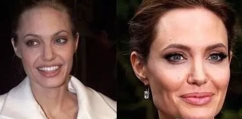 合肥眉間紋去除手術(shù)醫(yī)院性價比前十強推薦