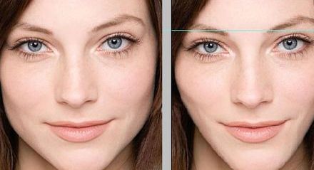 貴陽E光除皺好醫(yī)院，誰家口碑更棒？