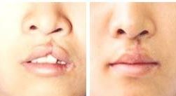 長沙十大雙眼皮整形醫(yī)院排行榜完整盤點(diǎn)