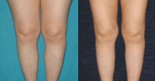 寶雞眼袋整形醫(yī)院大全：專業(yè)正規(guī)，解你的眼部煩惱