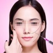 汕頭眼袋整形醫(yī)院十佳口碑榜，讓你的美麗更閃耀