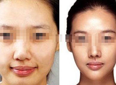 南京點(diǎn)陣激光去唇紋達(dá)人親推：口碑好的整形醫(yī)院Top10