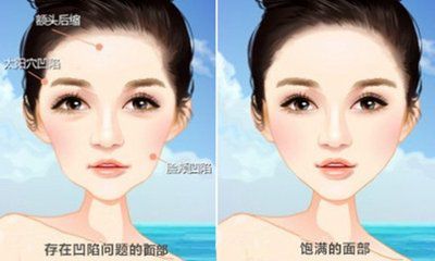 佛山自體細(xì)胞除皺美容醫(yī)院評分TOP10榜單揭秘！