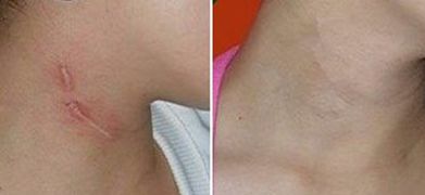 海南西部中心醫(yī)院院長林喜風簡介