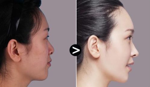 寧波醫(yī)療整形激光設(shè)備醫(yī)院排名大揭秘！前十強(qiáng)詳細(xì)解析