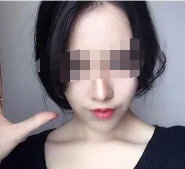 探尋福建小切口除疤痕紋醫(yī)院，權(quán)威榜單為你揭曉