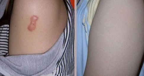 青島眼瞼修復(fù)名醫(yī)匯聚，哪家醫(yī)院實(shí)力更強(qiáng)？