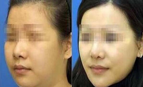 合肥哪家醫(yī)院能有效去除抬頭紋？推薦前10強(qiáng)