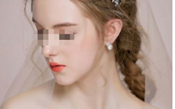 衡陽(yáng)水光針治療痘坑排名前十整形美容醫(yī)院對(duì)比