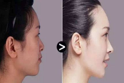 昆明微波治療腋臭醫(yī)院排名榜單，誰技術(shù)更專業(yè)？