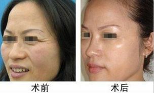 樂山祛疤手術(shù)哪家醫(yī)院口碑好？排名前十的整形醫(yī)院推薦！