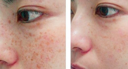 大同權(quán)威玻尿酸微整形醫(yī)院口碑排行榜