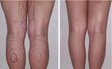 銀川痘印淡化最佳整形醫(yī)院排行榜TOP10，專(zhuān)家推薦【2024最新】