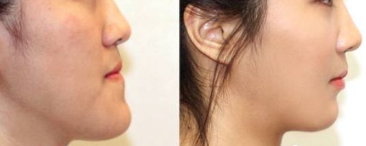 洛陽鼻尖矯正醫(yī)療整形醫(yī)院排行榜TOP10最新發(fā)布！