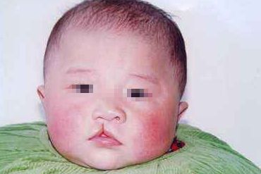 煙臺果酸喚膚整形醫(yī)院哪家技術(shù)更先進(jìn)？Top10技術(shù)實(shí)力大比拼