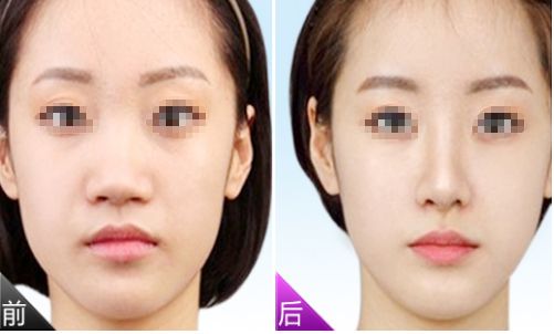 周口人氣最旺的飛秒鐳射祛斑醫(yī)院：線上預(yù)約指南