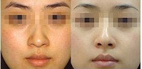 邢臺(tái)超聲刀整形機(jī)構(gòu)全攻略：前十名醫(yī)院詳細(xì)介紹