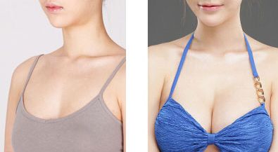 上海面部玻尿酸填充皺紋醫(yī)院口碑榜Top10