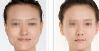 南昌哪家線雕醫(yī)院祛唇紋效果好？排行榜前十大醫(yī)療機構(gòu)揭秘