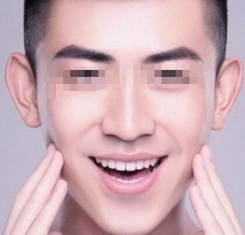 許昌哪家醫(yī)院祛雀斑口碑比較好？排名前10強醫(yī)療美容院揭秘！