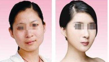 長春下巴疤痕修復(fù)醫(yī)療整形排行榜Top10實(shí)測匯總